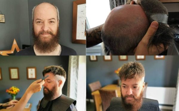 mens-hair-pieces-installation