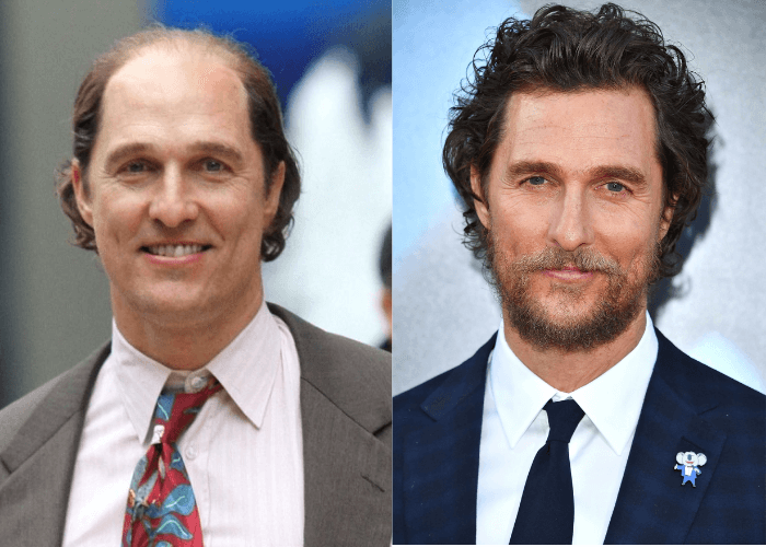 matthew_macconaughey_wearing_toupee-beforeafter-1