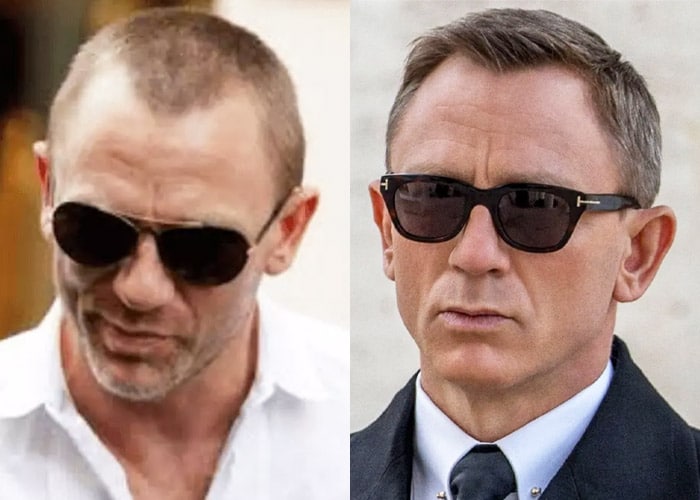 Daniel-Craig-hair-loss