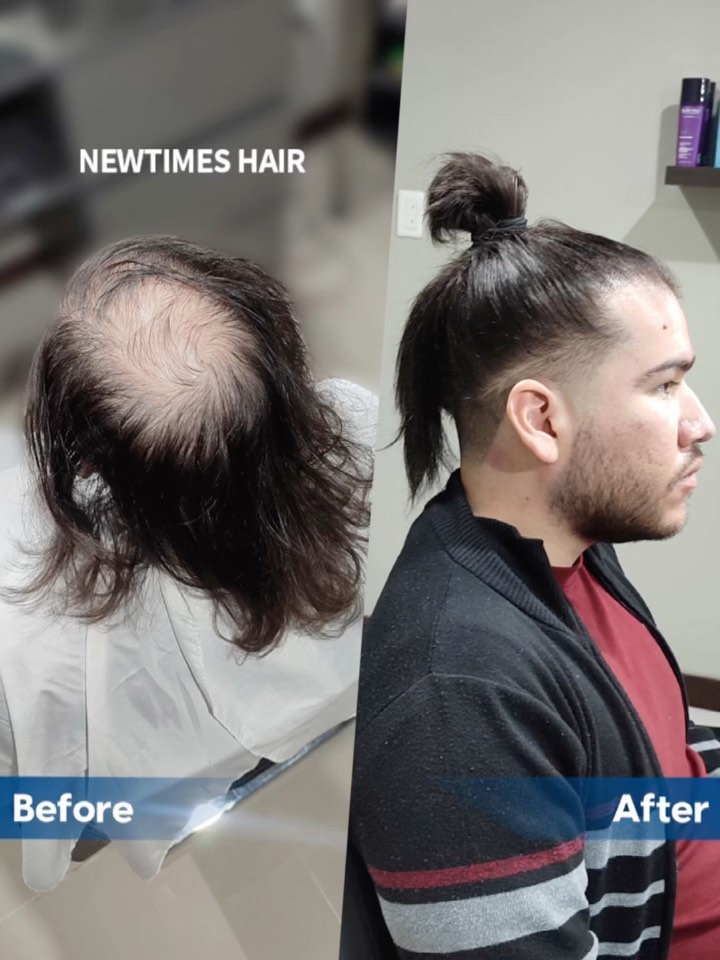 man bun for balding men with hair extensions