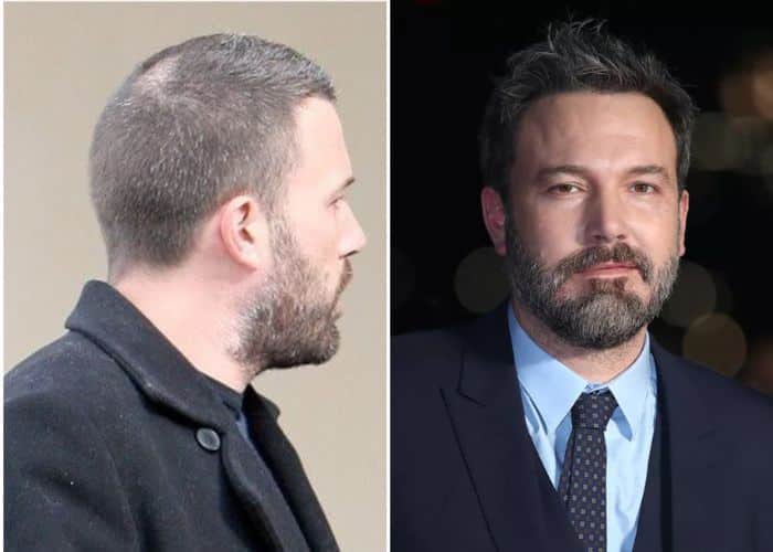 ben-affleck-wear-toupee-beforeafter