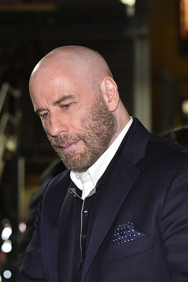 John-Travolta-hair-loss