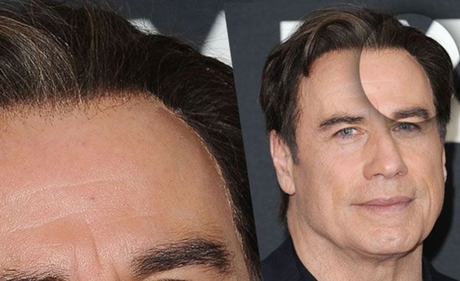 John-Travolta-wig-hairline-2