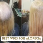 best-wigs-for-alopecia